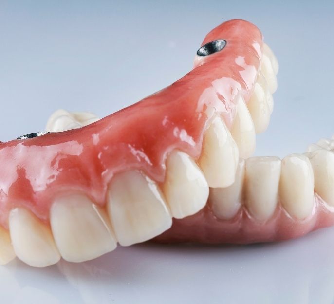 imagen de tratamiento de protesis dentales en bermeo