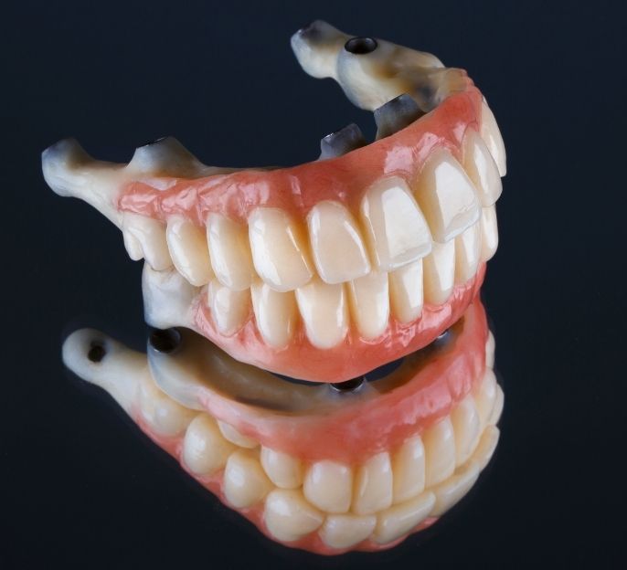 imagen de tratamiento de protesis dentales fijas en bermeo